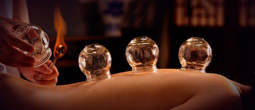 cupping