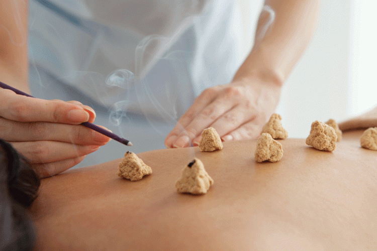 moxibustion