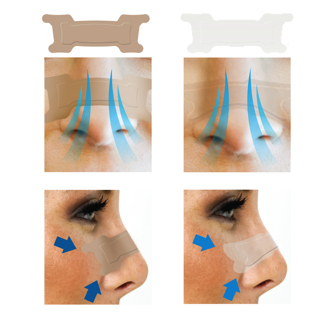 Nasal strip